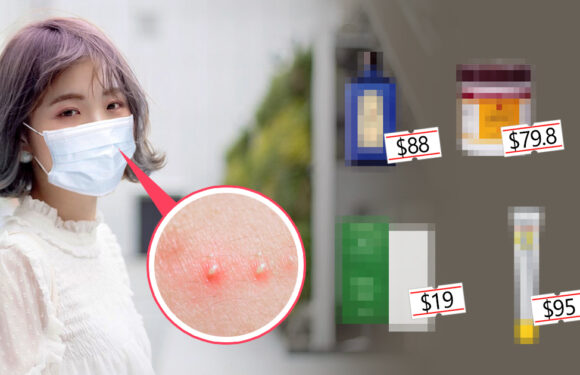 日本網民嚴選10件消 暗瘡 好物　最平只售港幣$19