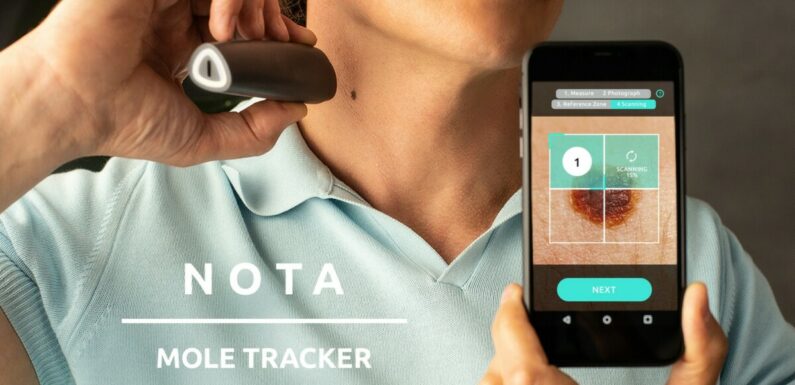 隨行痣檢測器 NOTA Mole Tracker (7月27日寄出) HK$ 3,100